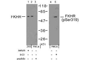 Image no. 1 for anti-Forkhead Box O1 (FOXO1) (Ser319) antibody (ABIN197366) (FOXO1 anticorps  (Ser319))