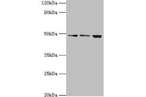 Western blot All lanes: ATP-dependent RNA helicase DDX39A antibody at 2 μg/mL Lane 1: A431 whole cell lysate Lane 2: 293T whole cell lysate Lane 3: HepG2 whole cell lysate Secondary Goat polyclonal to rabbit IgG at 1/10000 dilution Predicted band size: 50, 37, 31 kDa Observed band size: 50 kDa (DDX39 anticorps  (AA 178-427))