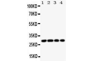 Western Blotting (WB) image for anti-Major Histocompatibility Complex, Class II, DM beta (HLA-DMB) (AA 81-100), (Middle Region) antibody (ABIN3044175)