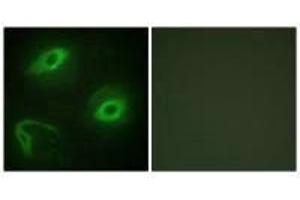 Immunofluorescence analysis of HeLa cells, using LATH antibody. (BPIFA4P anticorps)