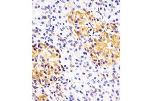 (ABIN390772 and ABIN2841030) staining Hsp 60 in human pancreas sections by Immunohistochemistry (IHC-P - paraformaldehyde-fixed, paraffin-embedded sections).