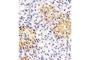 (ABIN390772 and ABIN2841030) staining Hsp 60 in human pancreas sections by Immunohistochemistry (IHC-P - paraformaldehyde-fixed, paraffin-embedded sections). (HSPD1 anticorps  (N-Term))