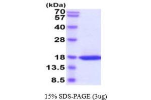 SDS-PAGE (SDS) image for Adiponectin (ADIPOQ) (AA 106-242) protein (His tag) (ABIN6387976)