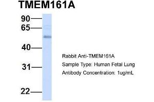 Host:  Rabbit  Target Name:  TMEM161A  Sample Type:  Human Fetal Lung  Antibody Dilution:  1. (TMEM161A anticorps  (Middle Region))