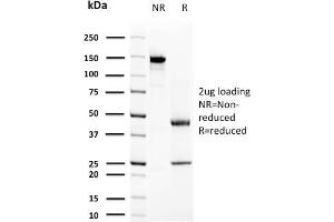 SDS-PAGE Analysis Purified Prolactin Mouse Monoclonal Antibody (PRL/2644).