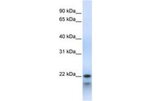 Image no. 1 for anti-Polymerase (RNA) III (DNA Directed) Polypeptide H (22.9kD) (POLR3H) (C-Term) antibody (ABIN6743479) (POLR3H anticorps  (C-Term))