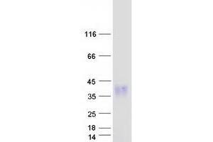 Validation with Western Blot