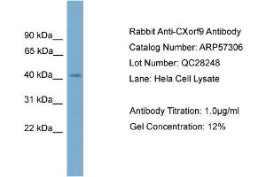 WB Suggested Anti-CXorf9  Antibody Titration: 0. (SASH3 anticorps  (C-Term))