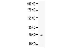 Western blot analysis of CD252 using anti-CD252 antibody .