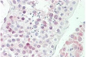 Human Testis: Formalin-Fixed, Paraffin-Embedded (FFPE) (NSG1 anticorps  (AA 112-161))