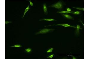 Immunofluorescence of monoclonal antibody to VAPA on HeLa cell.