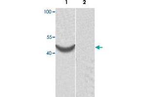 Western blot analysis of human fetal heart tissue lysate with ACTR1B polyclonal antibody  at 1:1000 dilution. (ACTR1B anticorps)