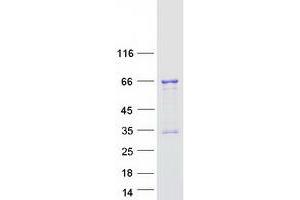 Validation with Western Blot (TCF3 Protein (Transcript Variant 2) (Myc-DYKDDDDK Tag))