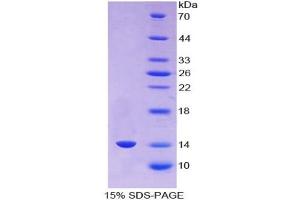 SDS-PAGE of Protein Standard from the Kit (Highly purified E.