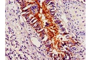 Immunohistochemistry of paraffin-embedded human lung tissue using ABIN7162886 at dilution of 1:100