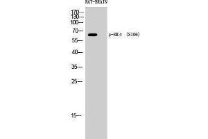 Western Blotting (WB) image for anti-Estrogen Receptor 1 (ESR1) (pSer106) antibody (ABIN3172892) (Estrogen Receptor alpha anticorps  (pSer106))