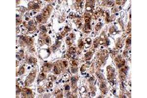 Immunohistochemistry of ACOT13 in human liver tissue with ACOT13 polyclonal antibody  at 2. (THEM2 anticorps  (C-Term))