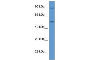 Western Blot showing CYP2W1 antibody used at a concentration of 1 ug/ml against Fetal Lung Lysate (CYP2W1 anticorps  (C-Term))