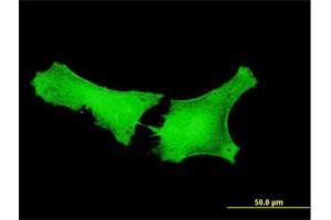 Immunofluorescence of purified MaxPab antibody to GPATCH2 on HeLa cell. (GPATCH2 anticorps  (AA 1-376))