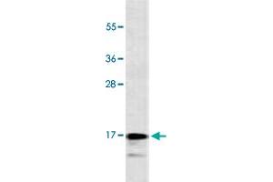 Western Blot analysis of CEM cell lysate (35 ug/lane) with CALCA monoclonal antibody, clone 406CT21. (CGRP anticorps  (AA 56-84))