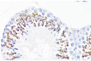 Immunohistochemistry of paraffin-embedded Mouse testis using CAMP Polyclonal Antibody at dilution of 1:200 (40x lens). (Cathelicidin anticorps)