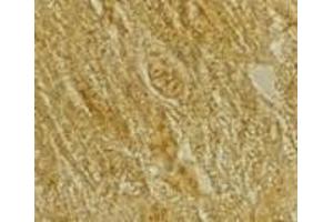 Immunohistochemistry of BACE2 in rat heart tissue with BACE2 antibody at 2 μg/ml.