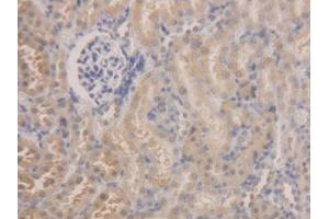 DAB staining on IHC-P; Samples: Rat Kidney Tissue (ALDH7A1 anticorps  (AA 28-539))