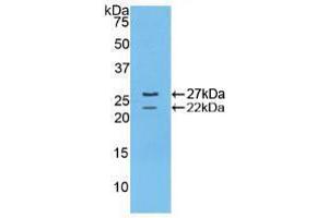 Western blot analysis of recombinant Mouse FBN1. (Fibrillin 1 anticorps  (AA 1701-1887))