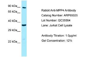 Western Blotting (WB) image for anti-Membrane Protein, Palmitoylated 4 (MAGUK P55 Subfamily Member 4) (MPP4) (C-Term) antibody (ABIN2790024) (MPP4 anticorps  (C-Term))