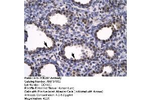 Human Lung (HMGB2 anticorps  (C-Term))