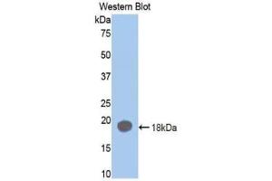 Western blot analysis of the recombinant protein. (Prothrombin anticorps  (AA 201-323))