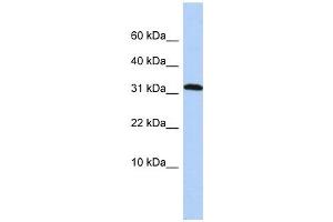 DYSFIP1 antibody used at 1 ug/ml to detect target protein. (PPP1R27 anticorps  (Middle Region))