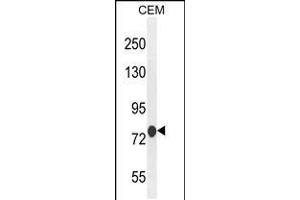 Western blot analysis in CEM cell line lysates (35ug/lane). (ATF7IP2 anticorps  (AA 318-347))