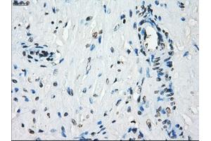 Immunohistochemical staining of paraffin-embedded Kidney tissue using anti-KDM4C mouse monoclonal antibody. (KDM4C anticorps)