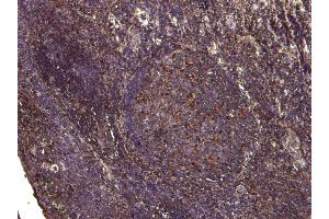 (ABIN185158) (6 μg/mL) staining of paraffin embedded Human Tonsil.