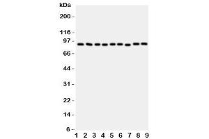 Western blot testing of VCP antibody and rat samples 1: brain (VCP anticorps  (C-Term))