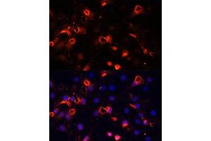 Immunofluorescence analysis of C6 cells using SMO Polyclonal Antibody (ABIN6130715, ABIN6148140, ABIN6148141 and ABIN6220185) at dilution of 1:100 (40x lens).