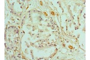 Immunohistochemistry of paraffin-embedded human prostate tissue using ABIN7146462 at dilution of 1:100