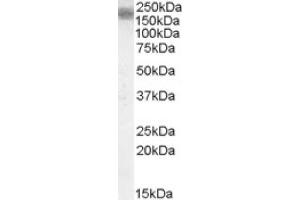 Image no. 1 for anti-Low Density Lipoprotein Receptor-Related Protein 4 (LRP4) (Internal Region) antibody (ABIN375019) (LRP4 anticorps  (Internal Region))