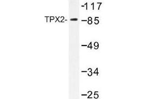 Image no. 2 for anti-TPX2, Microtubule-Associated, Homolog (Xenopus Laevis) (TPX2) antibody (ABIN317807) (TPX2 anticorps)