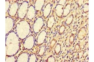 Immunohistochemistry of paraffin-embedded human stomach tissue using ABIN7163108 at dilution of 1:100 (CDS1 anticorps  (AA 6-85))