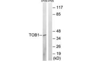 Western blot analysis of extracts from HT29 cells treated with serum 20% 15', using TOB1 (Phospho-Ser164) Antibody. (Protein Tob1 (TOB1) (AA 130-179), (pSer164) anticorps)