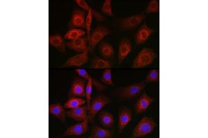Immunofluorescence analysis of NIH/3T3 cells using BiP/GRP78 Rabbit pAb (ABIN6134514, ABIN6142042, ABIN6142044 and ABIN6215180) at dilution of 1:100 (40x lens).