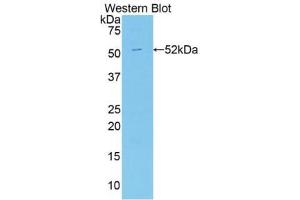 Western blot analysis of the recombinant protein. (Apelin anticorps  (AA 24-77))
