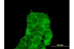 Immunofluorescence of purified MaxPab antibody to CHD9 on 293 cell.