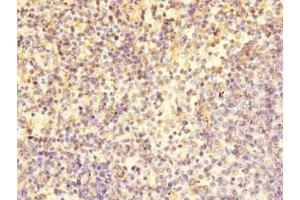 Immunohistochemistry of paraffin-embedded human spleen tissue using ABIN7171457 at dilution of 1:100 (LY9 anticorps  (AA 160-360))