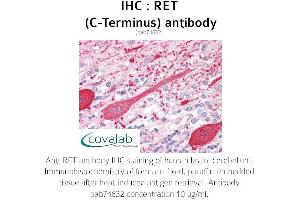 Image no. 1 for anti-Ret Proto-Oncogene (RET) (C-Term) antibody (ABIN5693697) (Ret Proto-Oncogene anticorps  (C-Term))