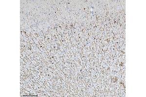 IHC analysis of CNPase/CNP using anti-CNPase/CNP antibody (ABIN7599377).