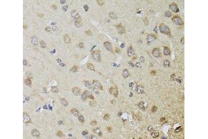 Immunohistochemistry of paraffin-embedded Rat brain using CHN1 Polyclonal Antibody at dilution of 1:100 (40x lens). (CHN1 anticorps)