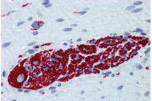 Human Small Intestine, Myenteric Plexus: Formalin-Fixed, Paraffin-Embedded (FFPE)